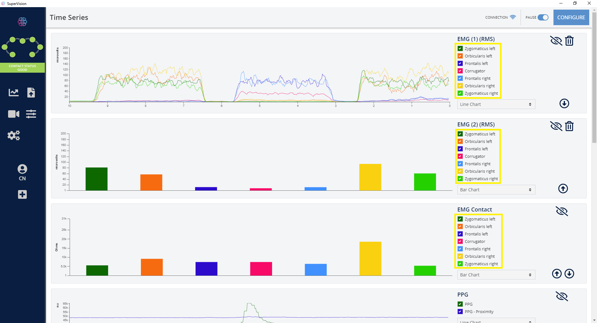 EMG Chart