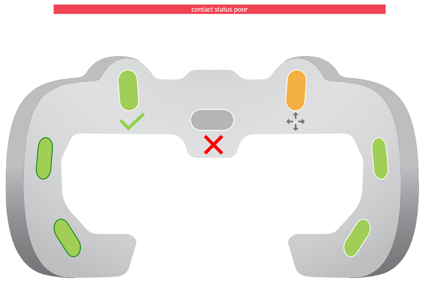 SuperVision sensor contact status